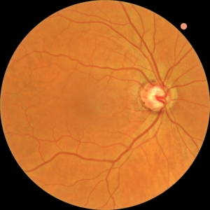 Fundus foto opname