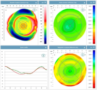 Afbeelding Eye profiler opname